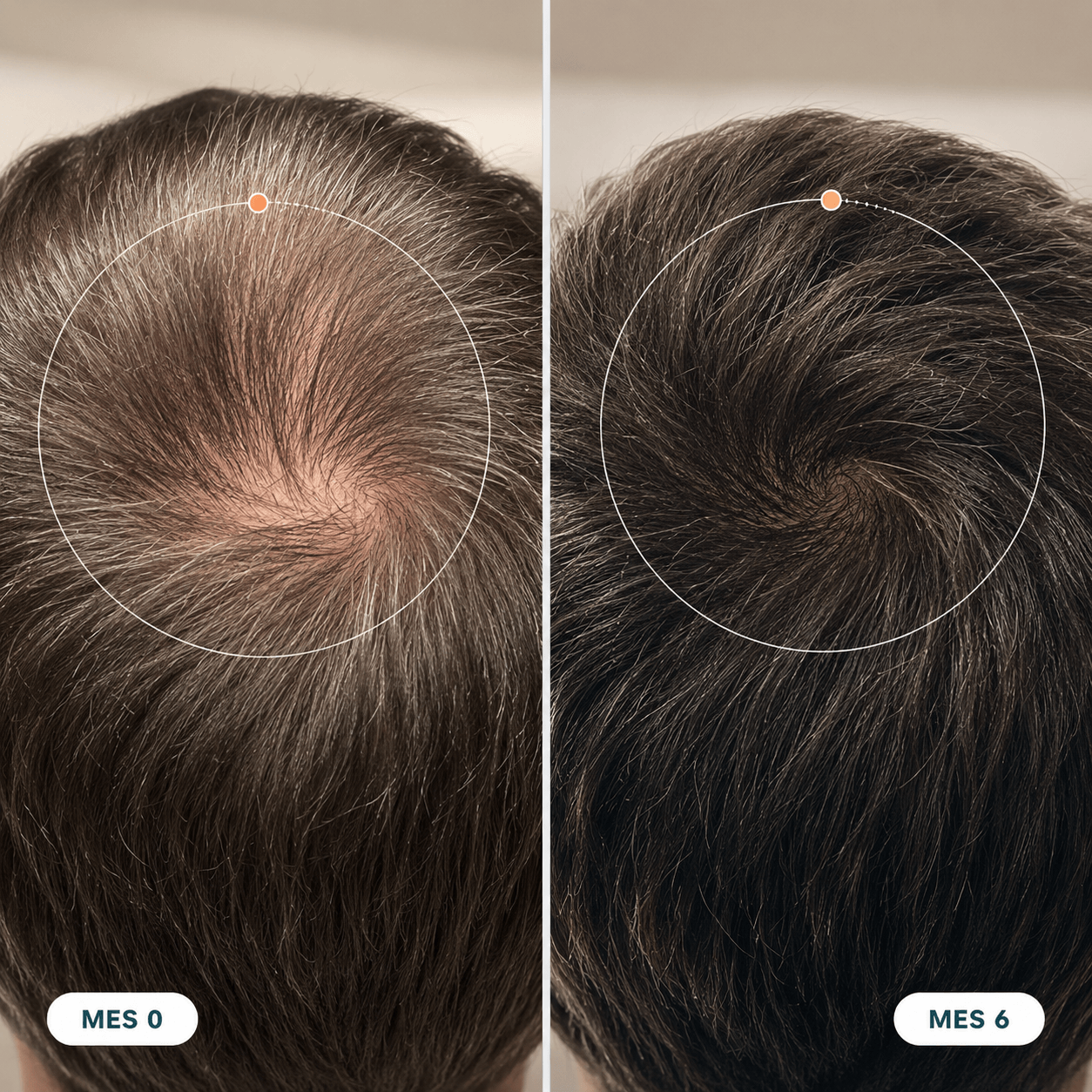 RAIZEN™ ORIGEN — Roll-On Anticaída para el Cabello