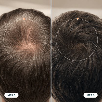 RAIZEN™ ORIGEN — Roll-On Anticaída para el Cabello