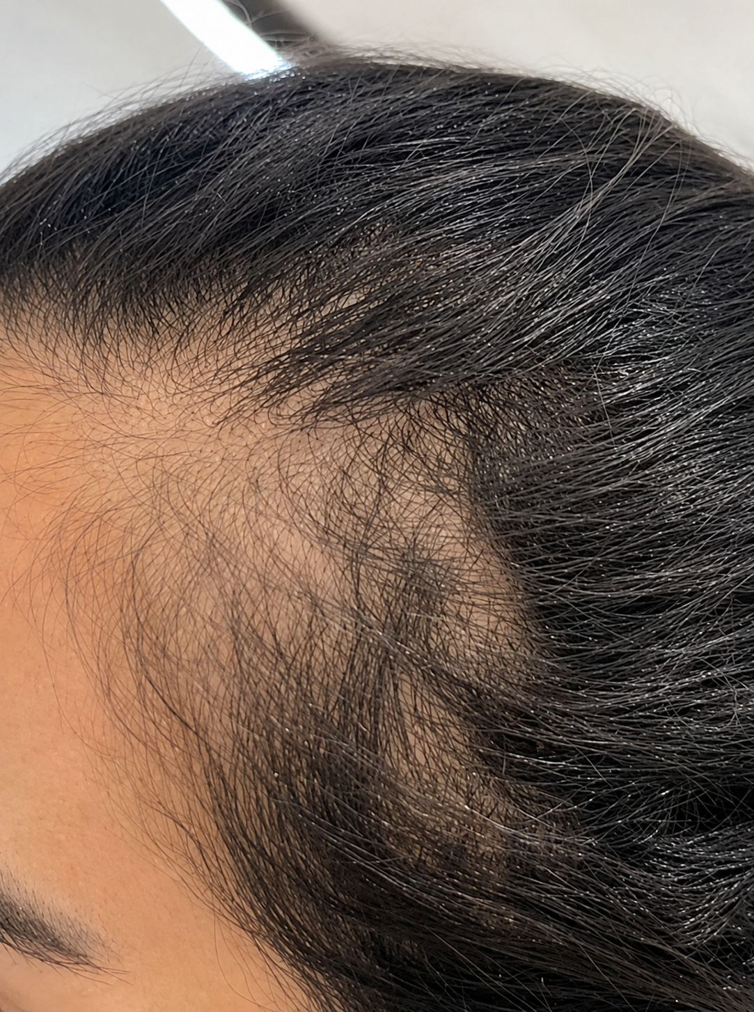 Cabello antes de usar Raizen